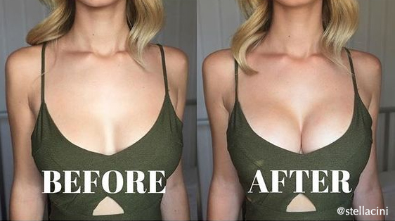 Upbra Cleavage Bra - Before & After